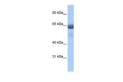 RFX4 Antibody, Novus Biologicals 100 &mu;L; Unconjugated:Antibodies, Polyclonal